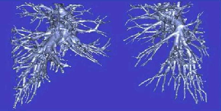 3D Structure of Left and Right Cardiovascular