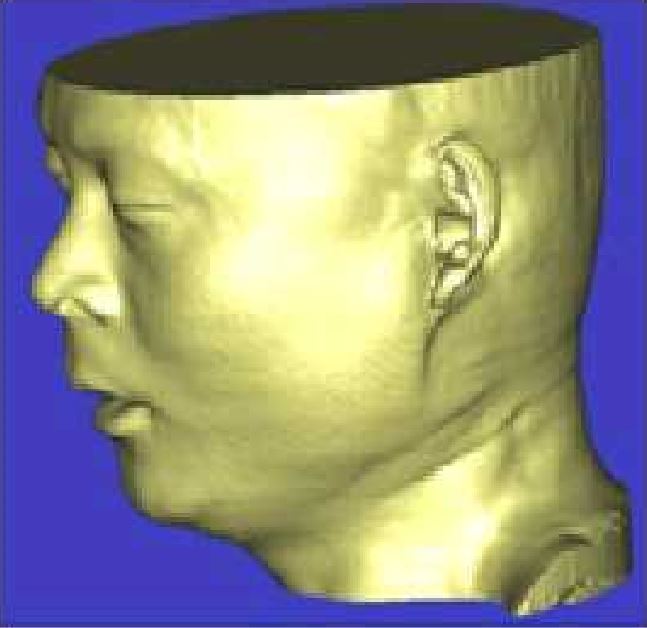 3D reconstruction
